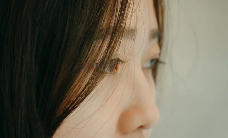 코 재수술 비용 실패 원인